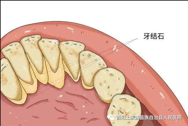 敲黑板！口腔健康小课堂来了